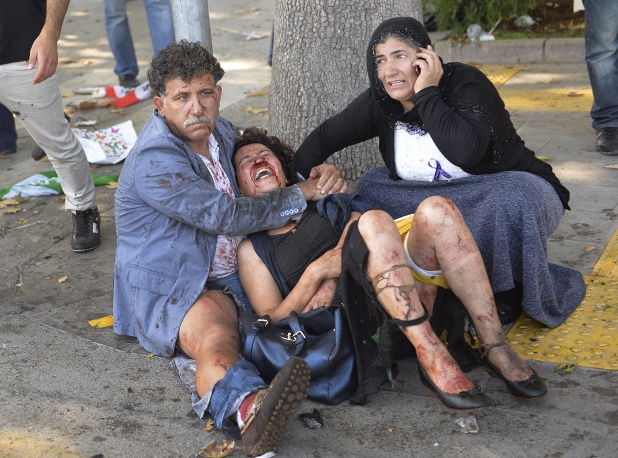 Жертвами взрывов в Анкаре стали 86 человек, пострадали более 200
