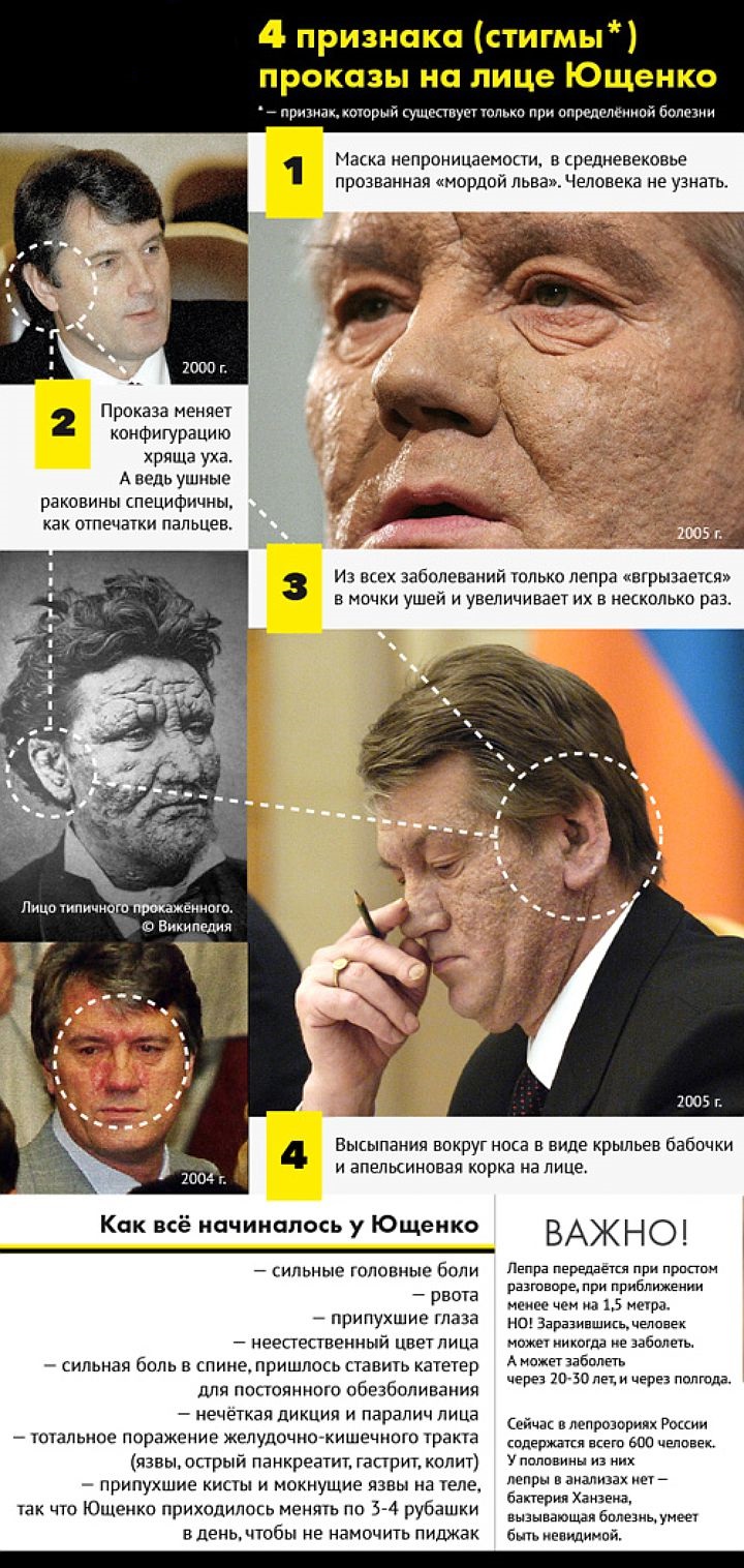 признаки